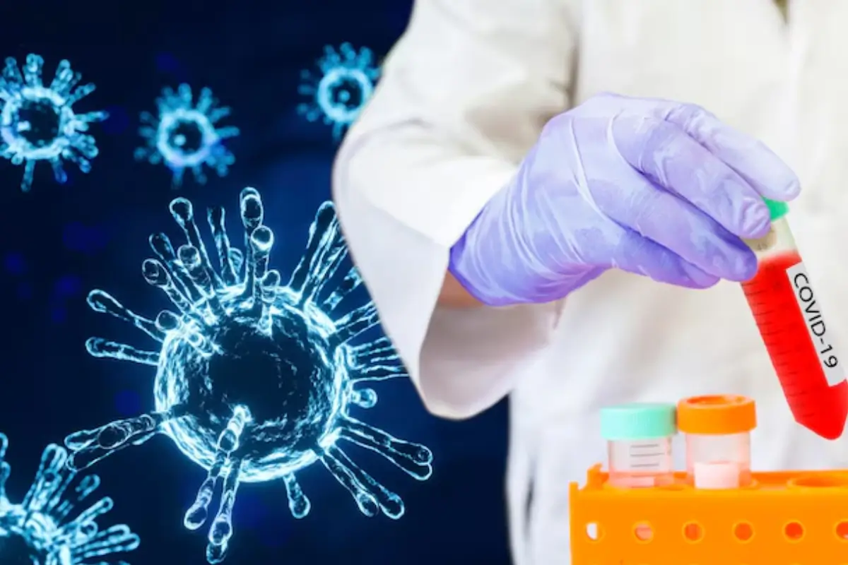 COVID-19 Advance Bio Markers